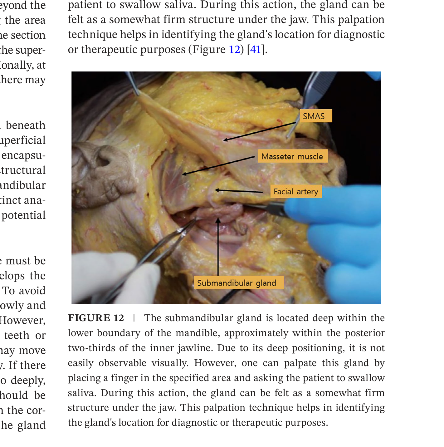 Submandibular gland