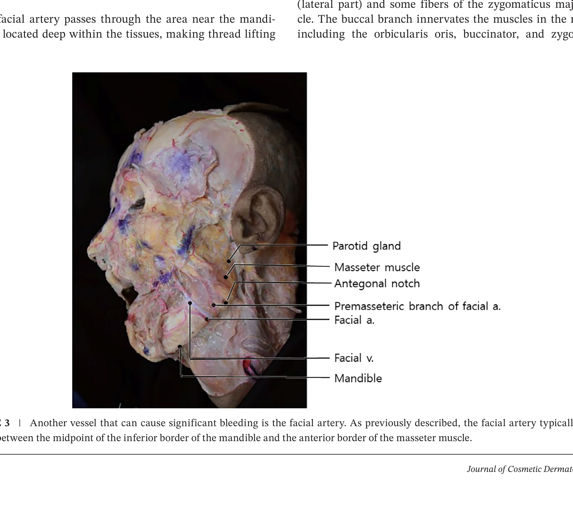 Facial artery